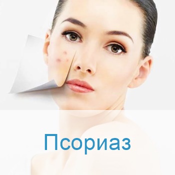 лечение псориаза в больницах Израиля