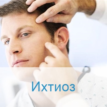 лечение ихтиоза в Израиле