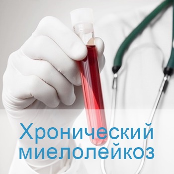 лечение хронического миелолекоза в больницах Израиля