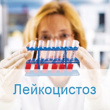 лечение лейкоцитоза в клиниках Израиля