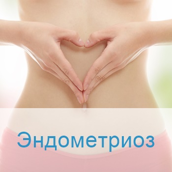 лечение эндометриоза в Израиле