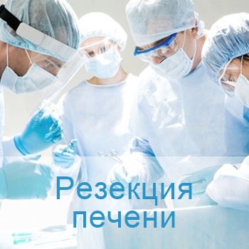 резекция печени в Израиле