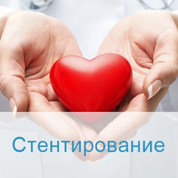 Стентирование в Израиле