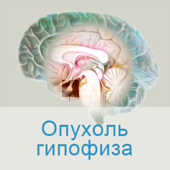 лечение гипофиза в больницах Израиля