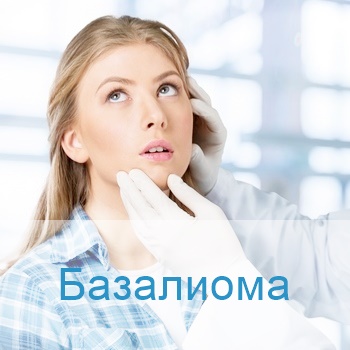 терапия базалиомы в Израиле