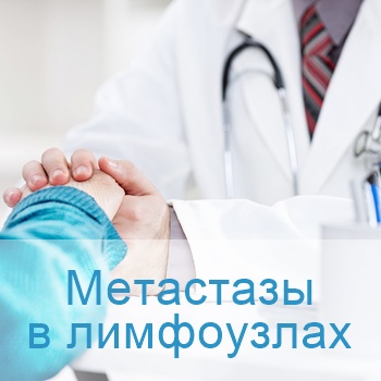 лечение метастазов в лимфатических узлах