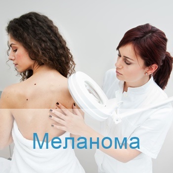 лечение меланомы в израильских клиниках