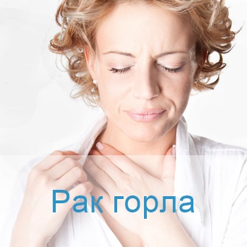 терапия рака горла в израильских клиниках