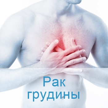 онкология грудины в израильских клиниках