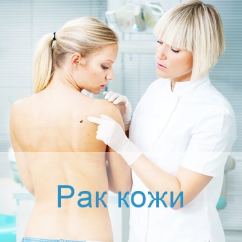 лечение онкологии кожи в Израиле