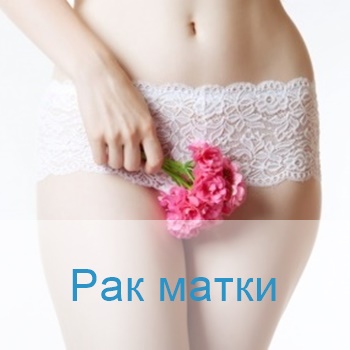 рак матки терапия в Израиле