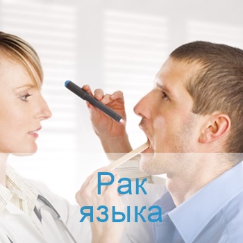 опухоль языка терапия в Израиле