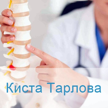 лечение кисты Тарлова в Израиле