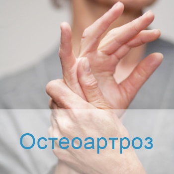 лечение остеоартроза в Израиле