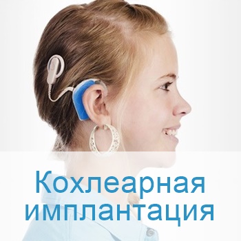 Кохлеарная имплантация в Израиле