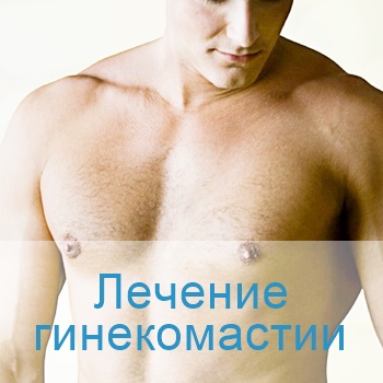 лечение гинекомастии в Израиле