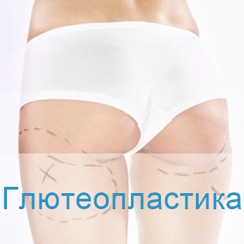 глютеопластика в Израиле