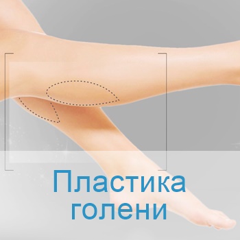 пластика голени в больницах Израиля
