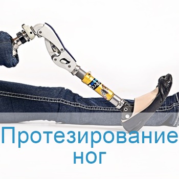 протезирование ног в Израиле