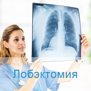 лобэктомия в Израиле