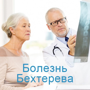 лечение болезни бехтерева в Израиле