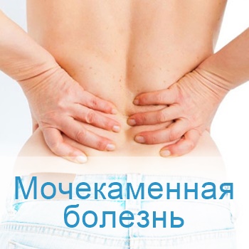 лечение мочекаменной болезни в больницах Израиля