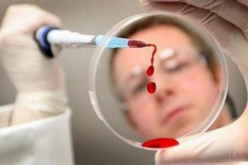 Лечение неходжкинской лимфомы в Израиле цены