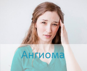 Узнать о лечении ангиомы в Израиле